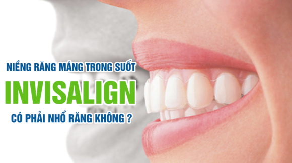 Niềng răng Invisalign có cần phải nhổ răng?