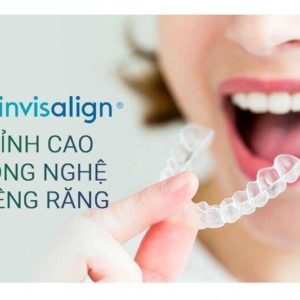 Niềng răng Invisalign bao lâu tái khám một lần?