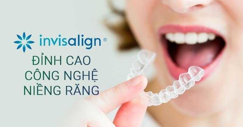 Niềng răng Invisalign bao lâu tái khám một lần?